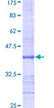 CSNK2A1 Protein - 12.5% SDS-PAGE Stained with Coomassie Blue.