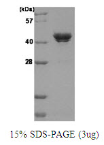 CSNK2A1 Protein