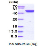 CSNK2A1 Protein