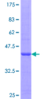 CSNK2A2 Protein - 12.5% SDS-PAGE Stained with Coomassie Blue.