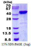CSNK2A2 Protein