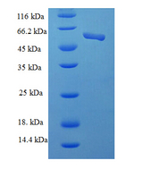 CSNK2A2 Protein