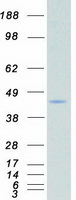 CSNK2A2 Protein - Purified recombinant protein CSNK2A2 was analyzed by SDS-PAGE gel and Coomassie Blue Staining