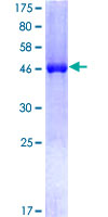 CSNK2B / Phosvitin Protein - 12.5% SDS-PAGE of human CSNK2B stained with Coomassie Blue