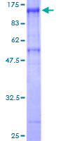 CSRNP1 / AXUD1 Protein - 12.5% SDS-PAGE of human AXUD1 stained with Coomassie Blue