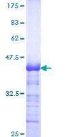 CSRNP3 Protein - 12.5% SDS-PAGE Stained with Coomassie Blue.