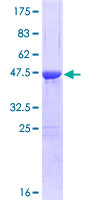 CSRP1 Protein - 12.5% SDS-PAGE of human CSRP1 stained with Coomassie Blue