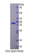 CSRP1 Protein - Recombinant Cysteine And Glycine Rich Protein 1 By SDS-PAGE