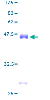 CSRP2 Protein - 12.5% SDS-PAGE of human CSRP2 stained with Coomassie Blue