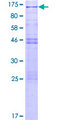 CSRP2BP Protein - 12.5% SDS-PAGE of human CSRP2BP stained with Coomassie Blue