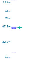 CSRP3 Protein - 12.5% SDS-PAGE of human CSRP3 stained with Coomassie Blue