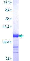 CSRP3 Protein - 12.5% SDS-PAGE Stained with Coomassie Blue.
