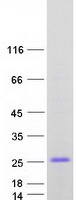 CSRP3 Protein - Purified recombinant protein CSRP3 was analyzed by SDS-PAGE gel and Coomassie Blue Staining