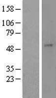 CST / GAL3ST1 Protein - Western validation with an anti-DDK antibody * L: Control HEK293 lysate R: Over-expression lysate