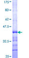CST / GAL3ST1 Protein - 12.5% SDS-PAGE Stained with Coomassie Blue.