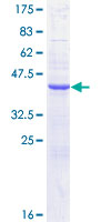CST1 / Cystatin SN Protein - 12.5% SDS-PAGE of human CST1 stained with Coomassie Blue