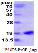CST1 / Cystatin SN Protein