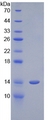 CST1 / Cystatin SN Protein - Recombinant Cystatin 1 By SDS-PAGE