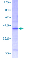 CST3 / Cystatin C Protein - 12.5% SDS-PAGE of human CST3 stained with Coomassie Blue