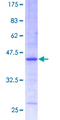 CST3 / Cystatin C Protein - 12.5% SDS-PAGE of human CST3 stained with Coomassie Blue