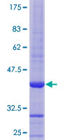 CST3 / Cystatin C Protein - 12.5% SDS-PAGE Stained with Coomassie Blue.