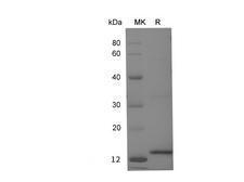CST3 / Cystatin C Protein - Recombinant Human Cystatin C/CST3 Protein (His Tag)-Elabsicence
