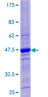 CST4 / Cystatin S Protein - 12.5% SDS-PAGE of human CST4 stained with Coomassie Blue