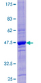 CST4 / Cystatin S Protein - 12.5% SDS-PAGE of human CST4 stained with Coomassie Blue