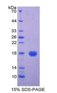 CST5 Protein - Recombinant Cystatin 5 By SDS-PAGE