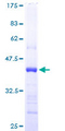 CST6 / Cystatin E/M Protein - 12.5% SDS-PAGE of human CST6 stained with Coomassie Blue