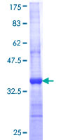 CST6 / Cystatin E/M Protein - 12.5% SDS-PAGE Stained with Coomassie Blue.