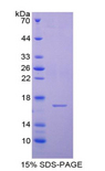 CST6 / Cystatin E/M Protein - Recombinant Cystatin 6 By SDS-PAGE