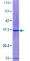 CST7 / Cystatin F Protein - 12.5% SDS-PAGE of human CST7 stained with Coomassie Blue