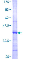 CST7 / Cystatin F Protein - 12.5% SDS-PAGE Stained with Coomassie Blue.
