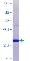 CST8 / CRES Protein - 12.5% SDS-PAGE of human CST8 stained with Coomassie Blue