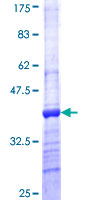 CST8 / CRES Protein - 12.5% SDS-PAGE Stained with Coomassie Blue.