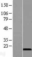 CST9L / Cystatin 9-Like Protein - Western validation with an anti-DDK antibody * L: Control HEK293 lysate R: Over-expression lysate