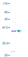 CST9L / Cystatin 9-Like Protein - 12.5% SDS-PAGE of human CST9L stained with Coomassie Blue