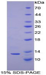 CSTA / Cystatin A Protein - Recombinant Cystatin A By SDS-PAGE