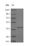 CSTB / Cystatin B / Stefin B Protein - (Tris-Glycine gel) Discontinuous SDS-PAGE (reduced) with 5% enrichment gel and 15% separation gel.