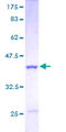 CSTB / Cystatin B / Stefin B Protein - 12.5% SDS-PAGE of human CSTB stained with Coomassie Blue