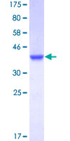 CSTB / Cystatin B / Stefin B Protein - 12.5% SDS-PAGE of human CSTB stained with Coomassie Blue
