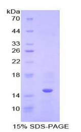 CSTB / Cystatin B / Stefin B Protein - Recombinant Cystatin B By SDS-PAGE