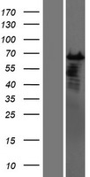 CSTF2T Protein - Western validation with an anti-DDK antibody * L: Control HEK293 lysate R: Over-expression lysate