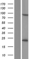 CSTF3 Protein - Western validation with an anti-DDK antibody * L: Control HEK293 lysate R: Over-expression lysate
