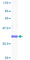 CSTF3 Protein - 12.5% SDS-PAGE of human CSTF3 stained with Coomassie Blue