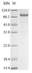 CT26 / DDX53 Protein - (Tris-Glycine gel) Discontinuous SDS-PAGE (reduced) with 5% enrichment gel and 15% separation gel.