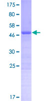 CT45A1 Protein - 12.5% SDS-PAGE of human XX-FW88277B6.1 stained with Coomassie Blue