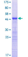 CT45A3 Protein - 12.5% SDS-PAGE of human CT45A3 stained with Coomassie Blue