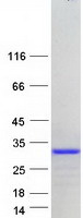 CT45A4 Protein - Purified recombinant protein CT45A4 was analyzed by SDS-PAGE gel and Coomassie Blue Staining
